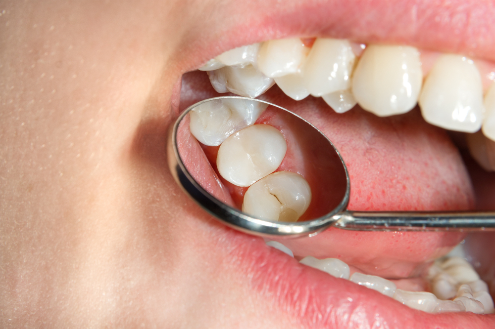 oral health